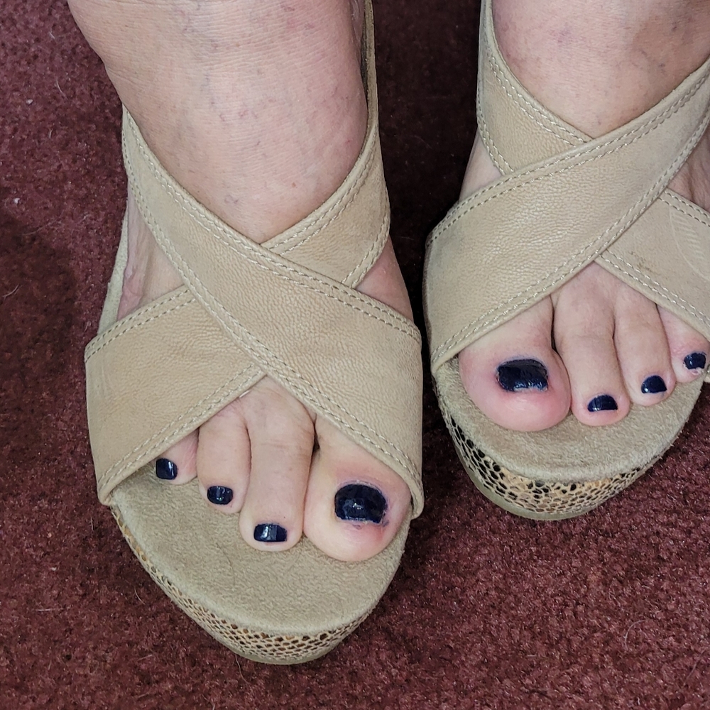 Wedges